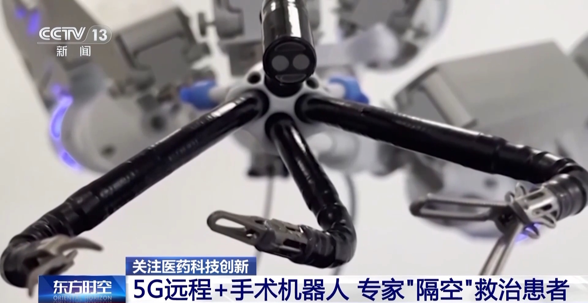 中国医疗“黑科技”改变看病就医体验重塑健康未来(图3)