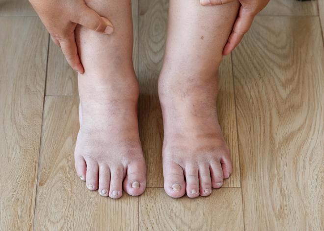 发出忠告：糖尿病患者出现这6个症状马上去医院(图6)