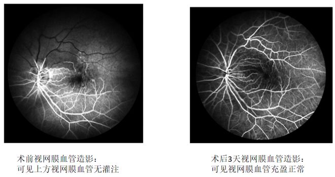 浙江70岁男子坐公交司机一个动作他眼睛就看不见了！医生：细胞不可逆死亡(图2)