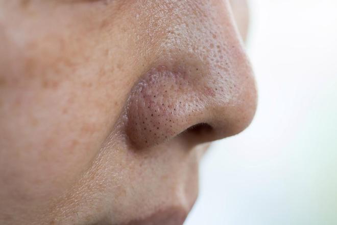 乐虎国际为什么患上2型糖尿病？糖尿病给过你5次机会可惜一次也没把握住(图6)