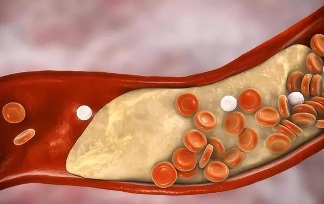 研究发现：每日饮酒的糖尿病人大多临近60岁或有5种异样(图3)