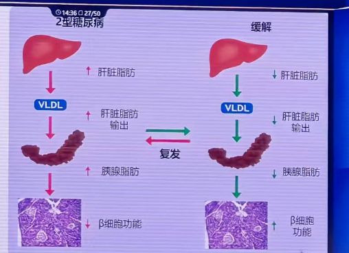 乐虎国际全球14糖尿病患者在中国？3大病因揭秘……(图4)